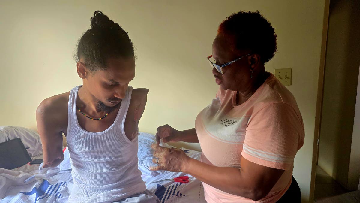 Bridgette Samuels Johnson dresses her son Chace Singh’s wounds at their home in Holland Estate, Trelawny.
