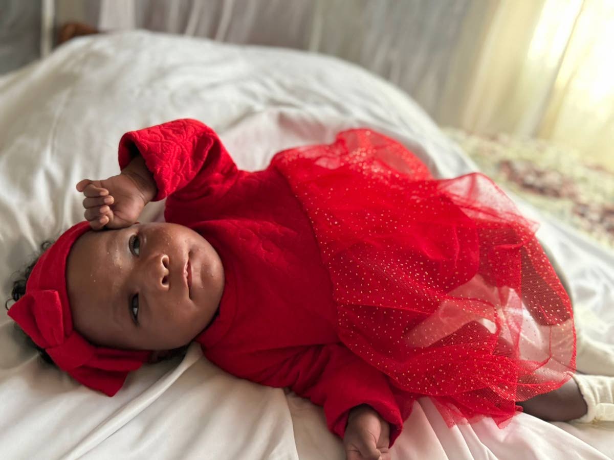 Anna-Olivia Gardener, who has been diagnosed with Patau syndrome, or Trisomy 13